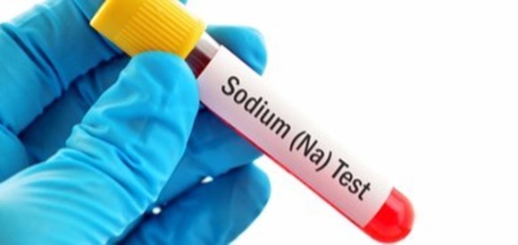 בדיקת רמת נתרן בדם (Sodium/Natrium) - תמונה